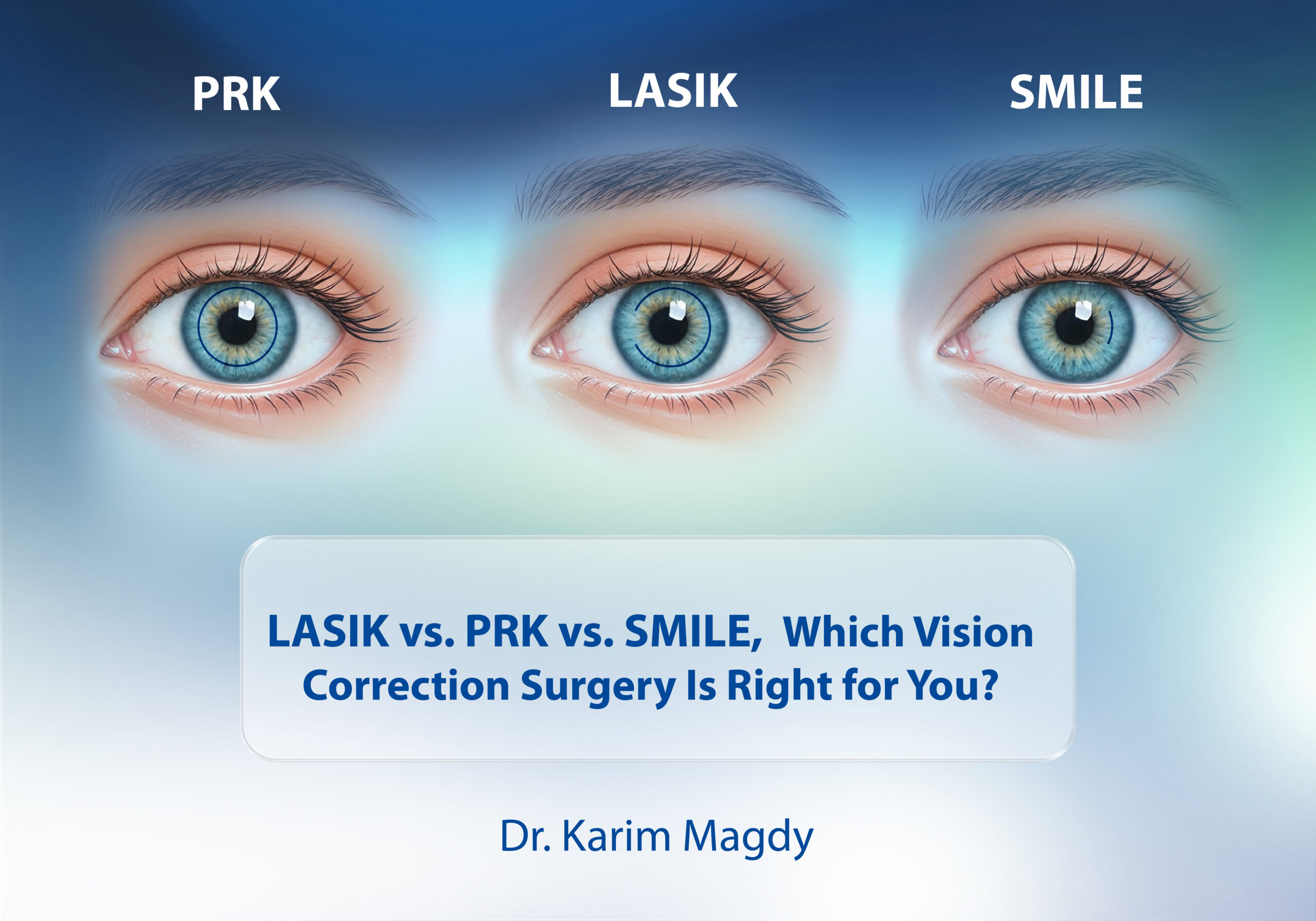 LASIK vs. PRK vs. SMILE: Which Vision Correction Surgery Is Right for You?