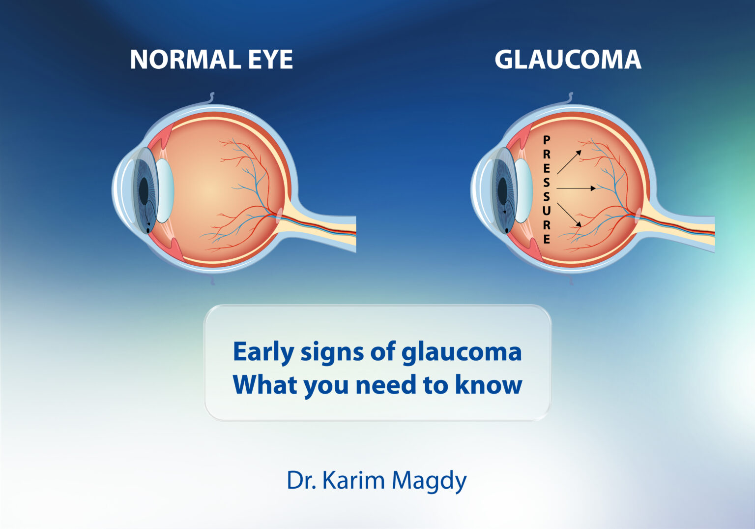 Early Signs of Glaucoma: What You Need to Know – Dr Karim Magdi
