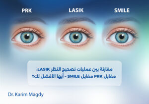 مقارنة بين عمليات تصحيح النظر: LASIK مقابل PRK مقابل SMILE – أيها الأفضل لك؟