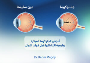 أعراض الجلوكوما المبكرة وكيفية اكتشافها قبل فوات الأوان